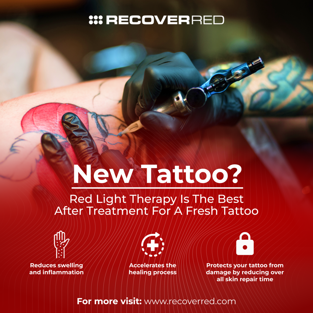 Tattoo removal, Techniques, Results, Recovery and Guidelines |